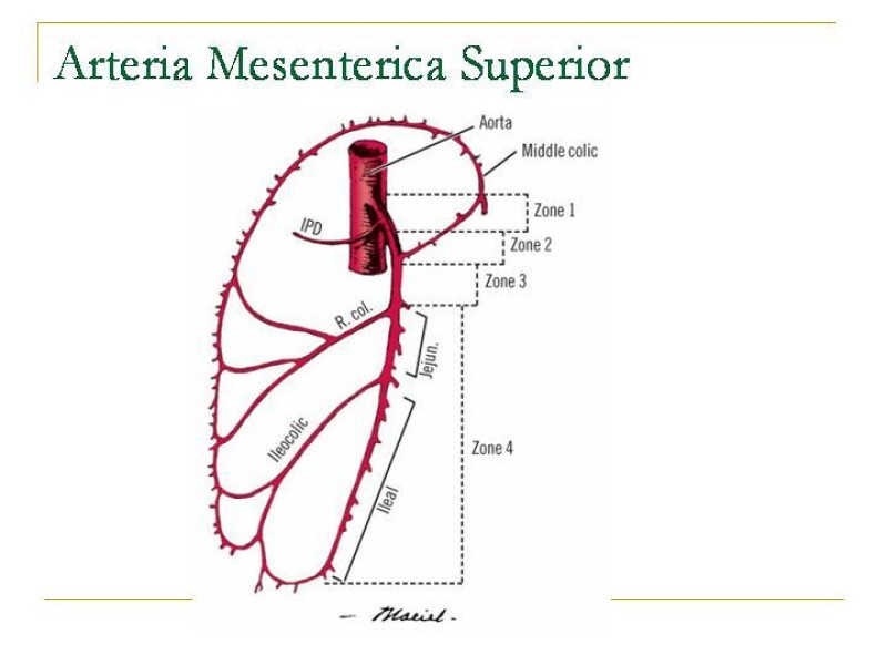 Diapositiva 65 de Accesos vasculares Abdominales