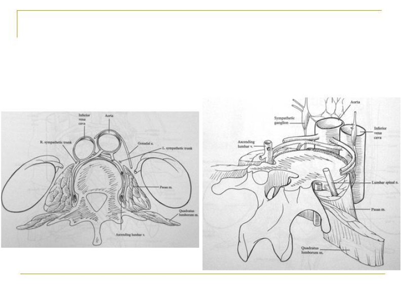 Diapositiva 48 de Accesos vasculares Abdominales