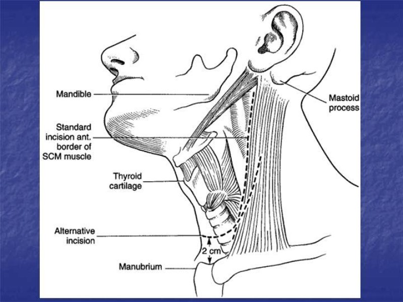 Diapositiva 26 de Abordaje Quirúrgico Vasculares