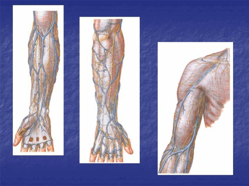 Diapositiva 76 de Abordaje Quirúrgico Vasculares