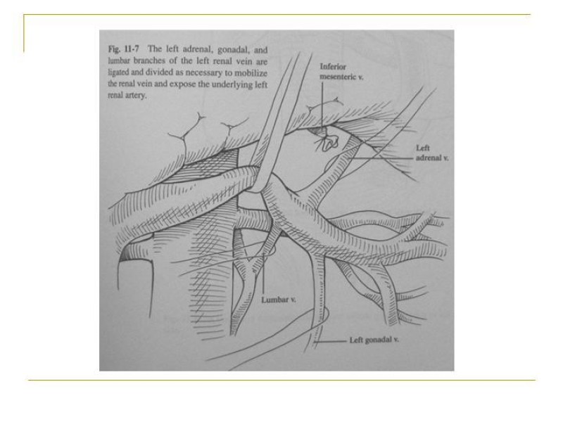Diapositiva 31 de Accesos vasculares Abdominales