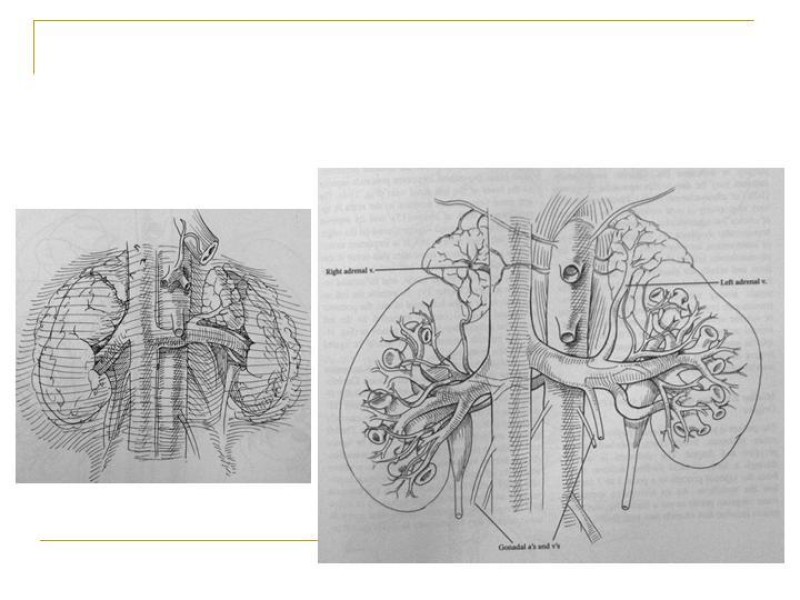 Diapositiva 84 de Accesos vasculares Abdominales