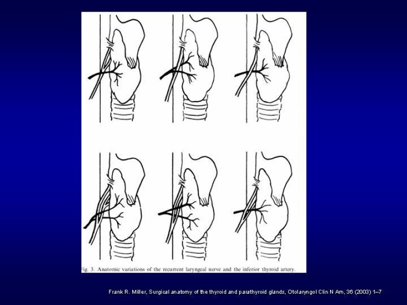 Diapositiva 11 de Tiroidectomía