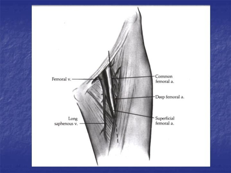 Diapositiva 93 de Abordaje Quirúrgico Vasculares