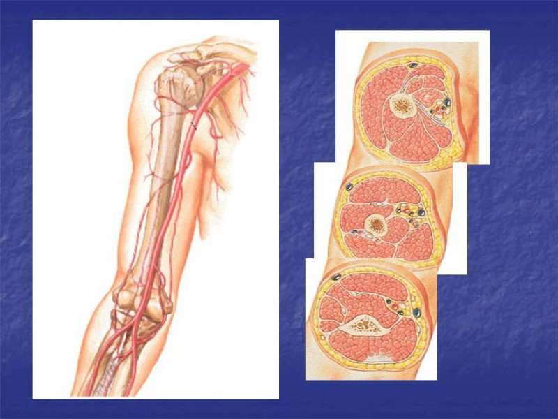 Diapositiva 60 de Abordaje Quirúrgico Vasculares