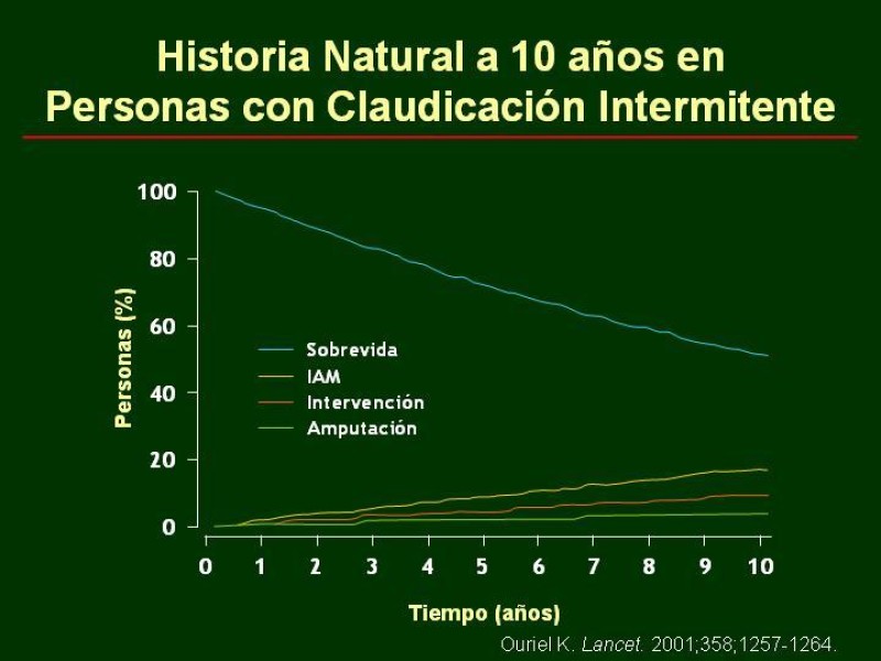 Diapositiva 20 de Clínica , Epidemiología y Factores Etiológicos de la Enf. Arterial Oclusiva Crónica