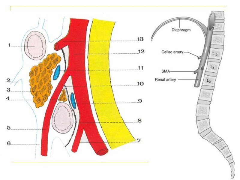 Diapositiva 4 de Accesos vasculares Abdominales