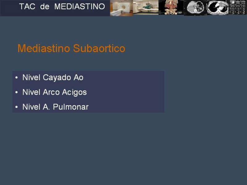 Diapositiva 11 de Imaginología Toráxica TAC