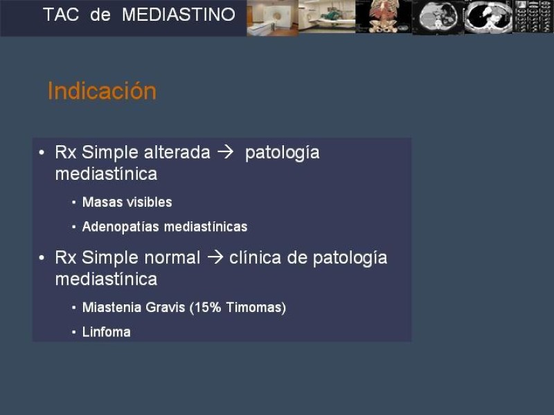 Diapositiva 3 de Imaginología Toráxica TAC