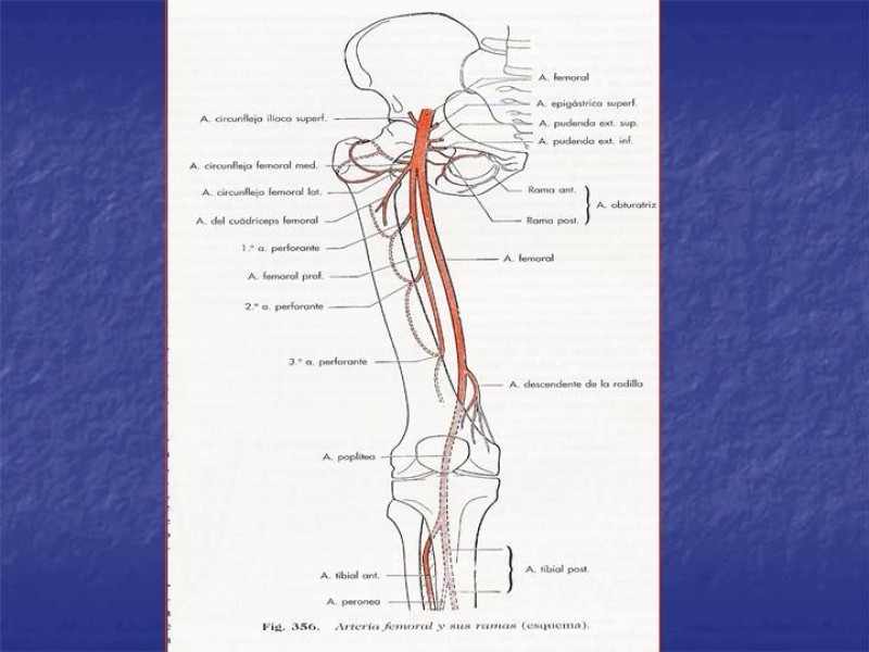 Diapositiva 83 de Abordaje Quirúrgico Vasculares