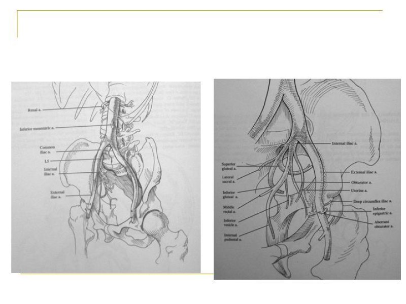 Diapositiva 46 de Accesos vasculares Abdominales