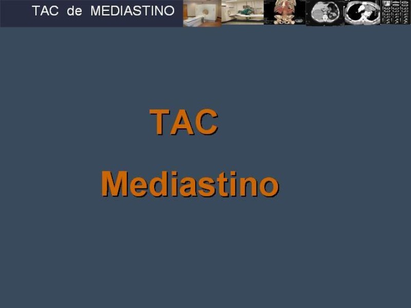 Diapositiva 2 de Imaginología Toráxica TAC