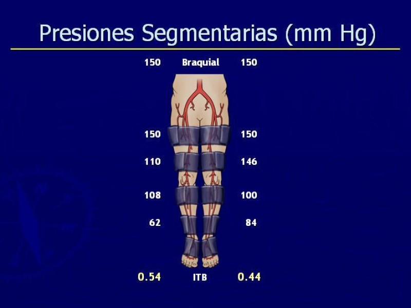 Diapositiva 31 de Clasificación, Definiciones y Estudio de EAO 