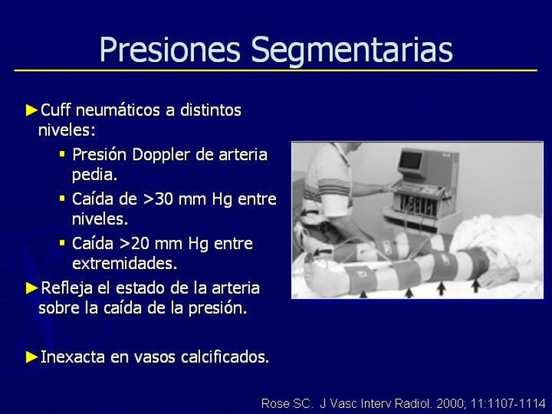 Diapositiva 30 de Clasificación, Definiciones y Estudio de EAO 