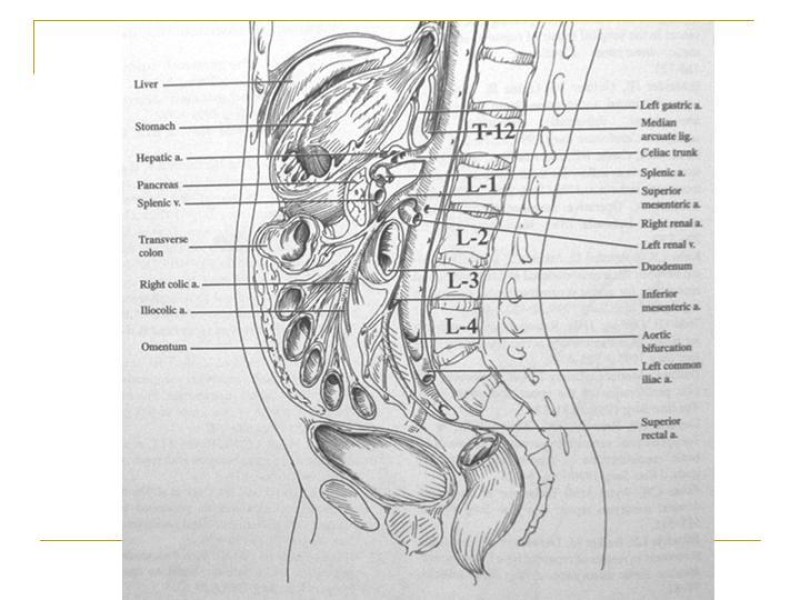 Diapositiva 58 de Accesos vasculares Abdominales