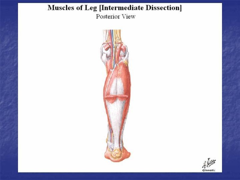 Diapositiva 86 de Abordaje Quirúrgico Vasculares