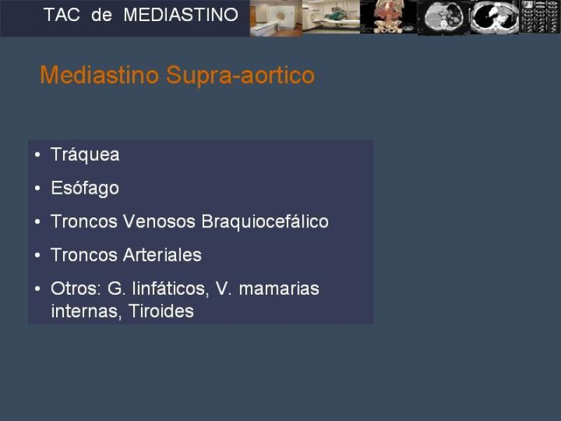 Diapositiva 6 de Imaginología Toráxica TAC