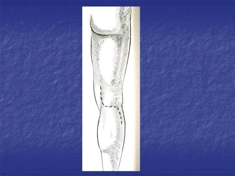 Diapositiva 103 de Abordaje Quirúrgico Vasculares