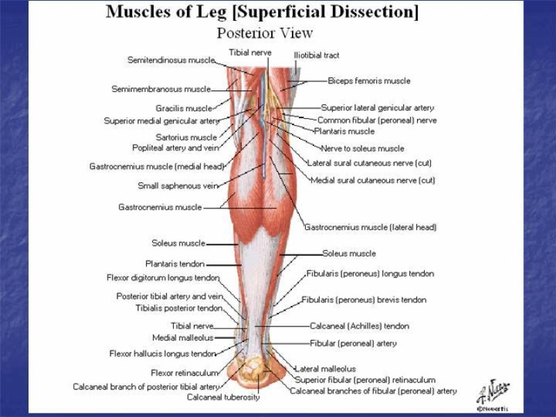 Diapositiva 85 de Abordaje Quirúrgico Vasculares