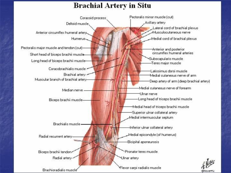 Diapositiva 59 de Abordaje Quirúrgico Vasculares