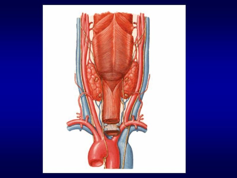 Diapositiva 10 de Tiroidectomía