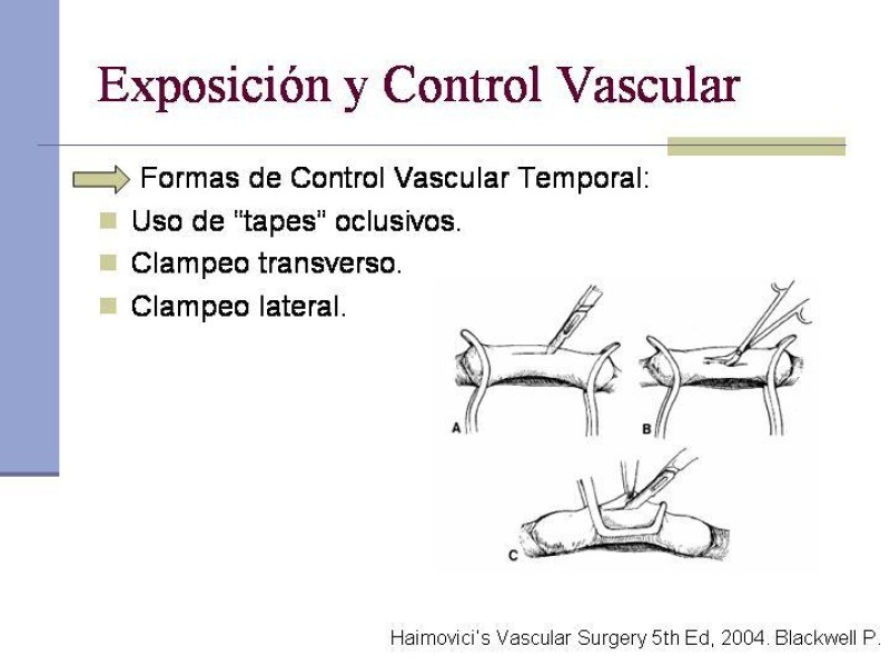 Diapositiva 6 de Reparación y Anastomosis Vasculares