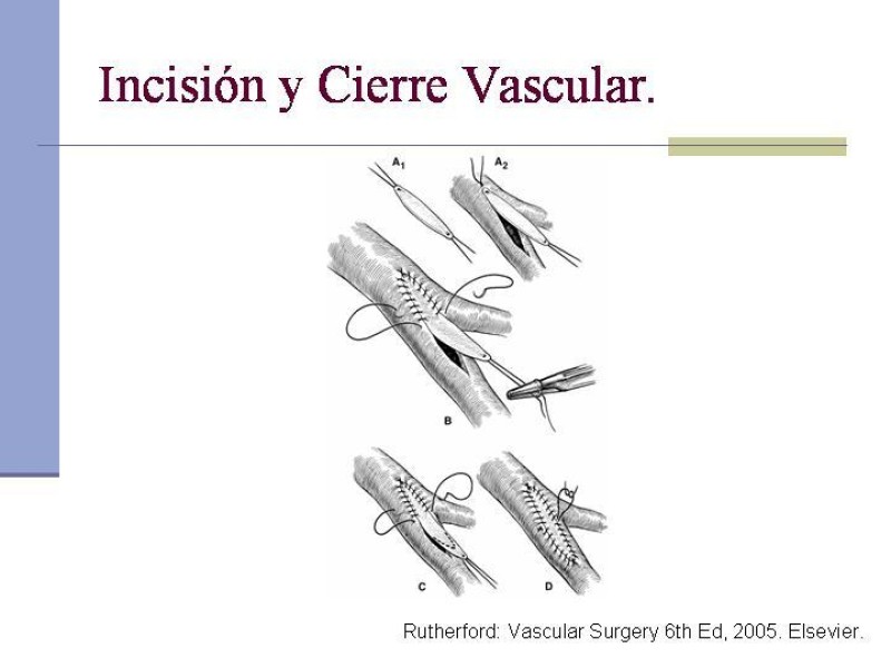 Diapositiva 17 de Reparación y Anastomosis Vasculares