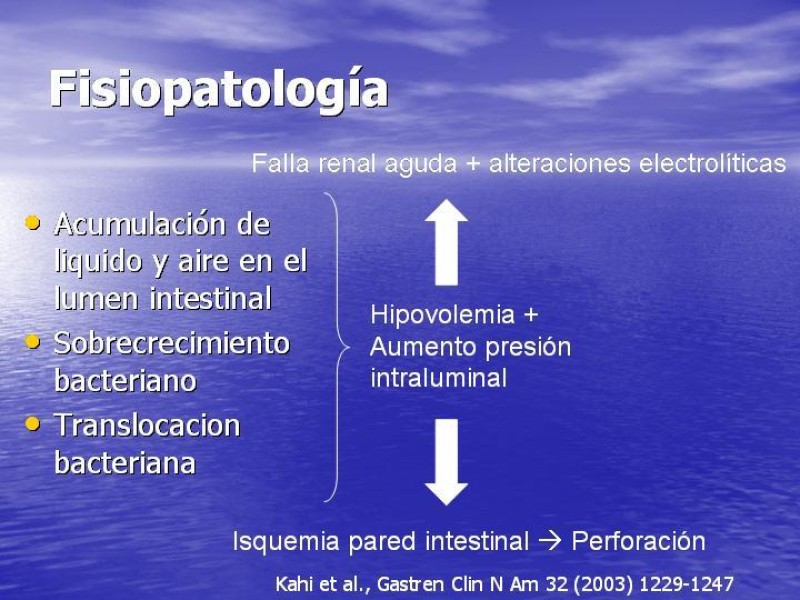 Diapositiva 3 de Obstrucción Intestinal: Estudio Diagnostico y Manejo inicial