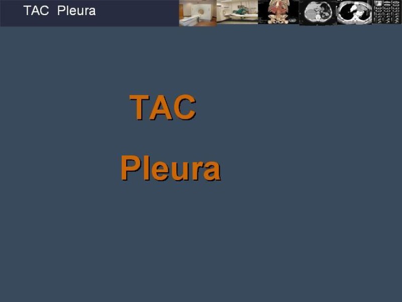 Diapositiva 65 de Imaginología Toráxica TAC