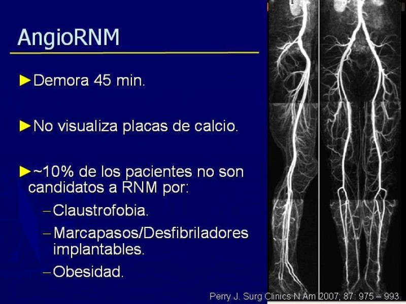 Diapositiva 45 de Clasificación, Definiciones y Estudio de EAO 