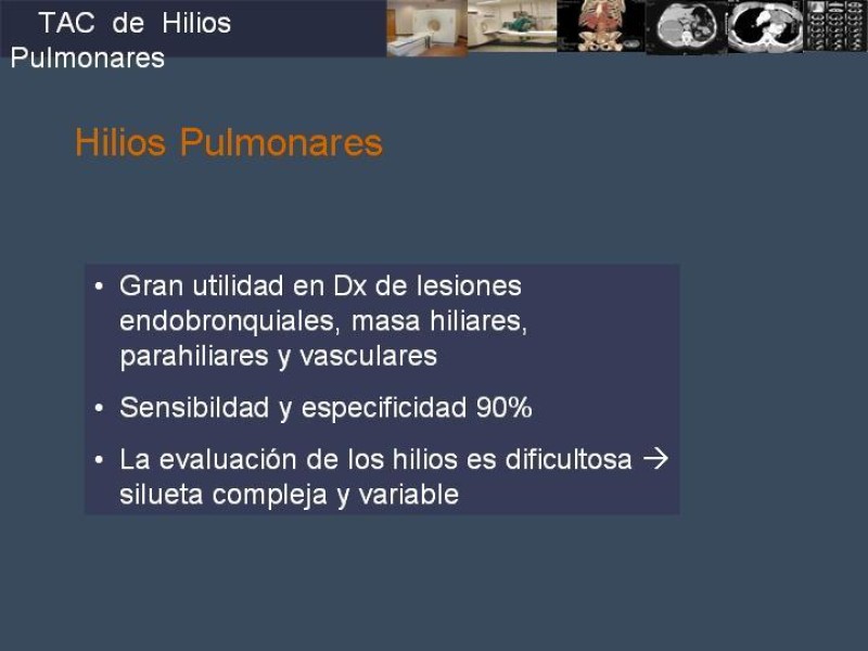 Diapositiva 43 de Imaginología Toráxica TAC