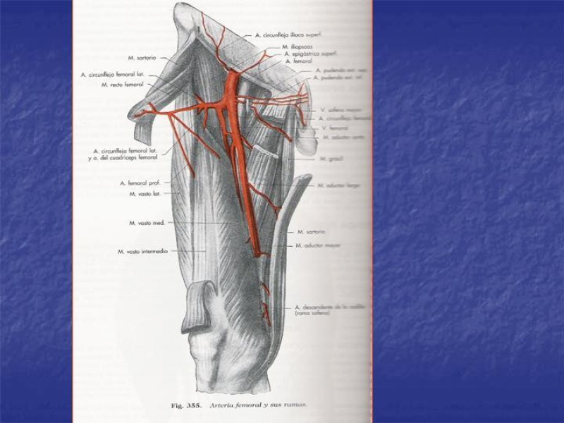 Diapositiva 82 de Abordaje Quirúrgico Vasculares