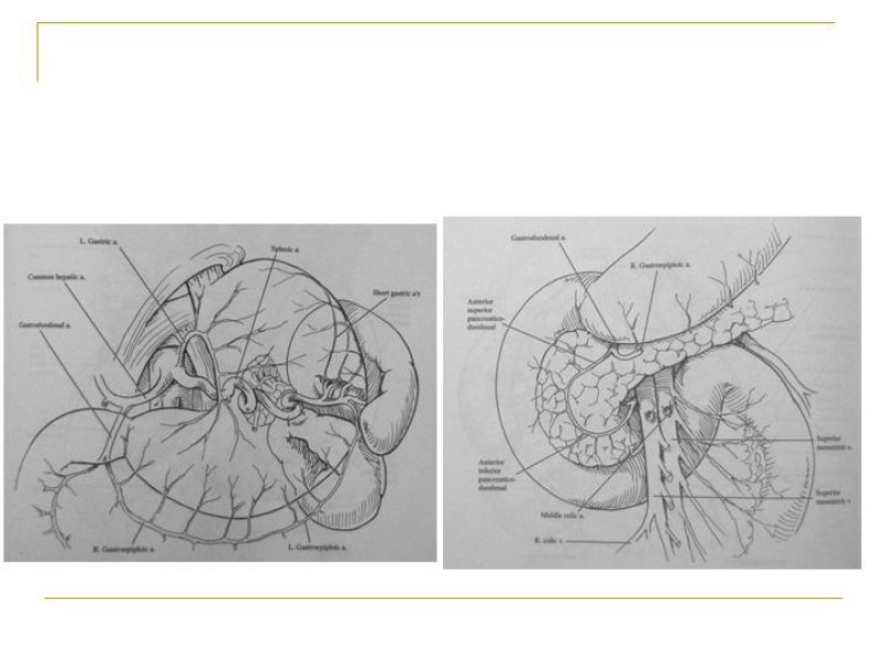 Diapositiva 61 de Accesos vasculares Abdominales