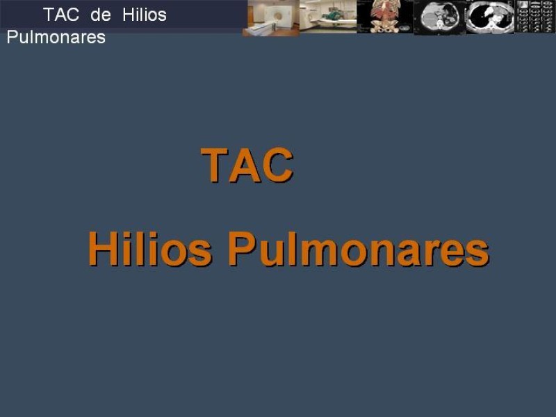 Diapositiva 42 de Imaginología Toráxica TAC
