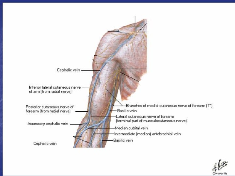 Diapositiva 77 de Abordaje Quirúrgico Vasculares