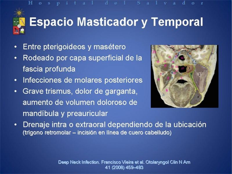 Diapositiva 18 de Abscesos Cervicales Profundos