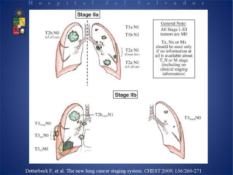Diapositiva 21 de Cáncer Pulmonar