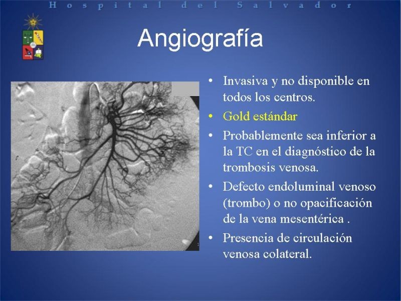 Diapositiva 12 de Trombosis Venosa Mesentérica