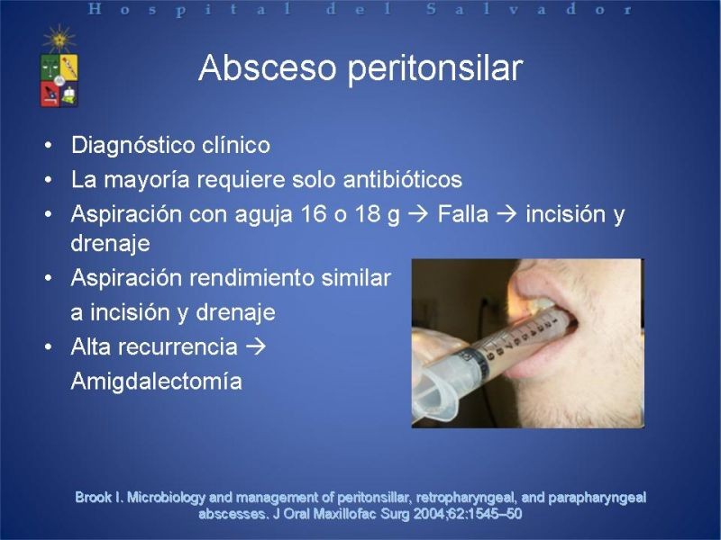 Diapositiva 12 de Abscesos Cervicales Profundos