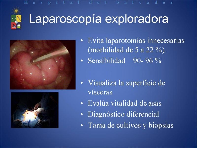 Diapositiva 13 de Trombosis Venosa Mesentérica