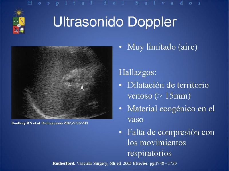 Diapositiva 10 de Trombosis Venosa Mesentérica