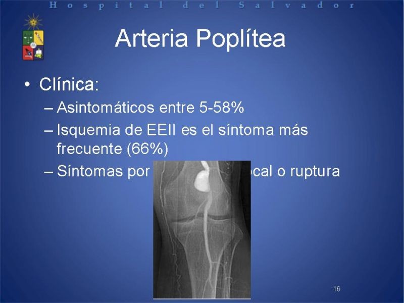 Diapositiva 15 de Aneurismas periféricos