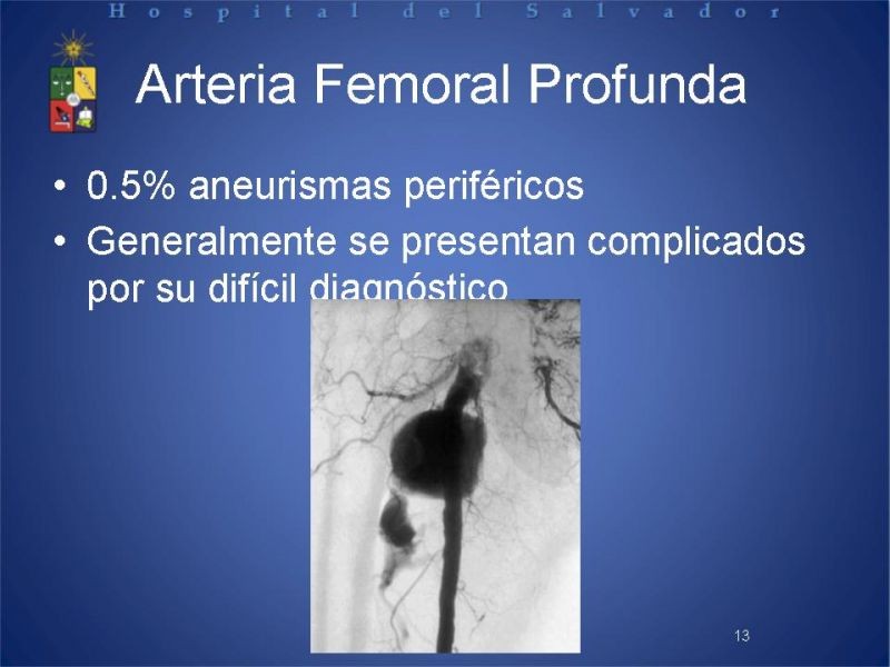 Diapositiva 12 de Aneurismas periféricos