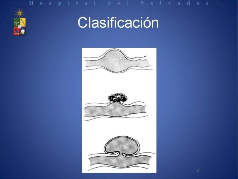Diapositiva 4 de Aneurismas periféricos