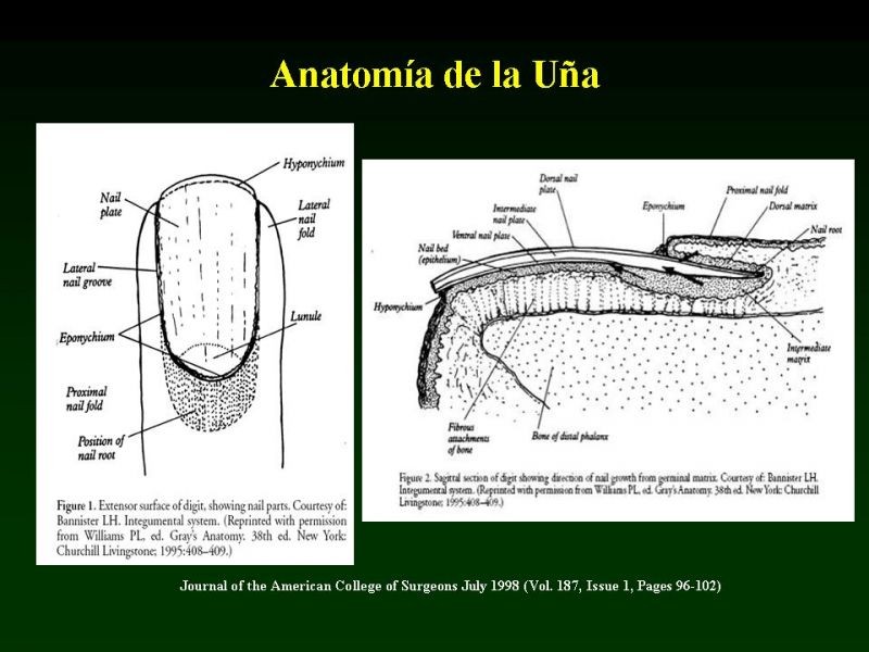 Diapositiva 2 de Técnica de la Onicectomía