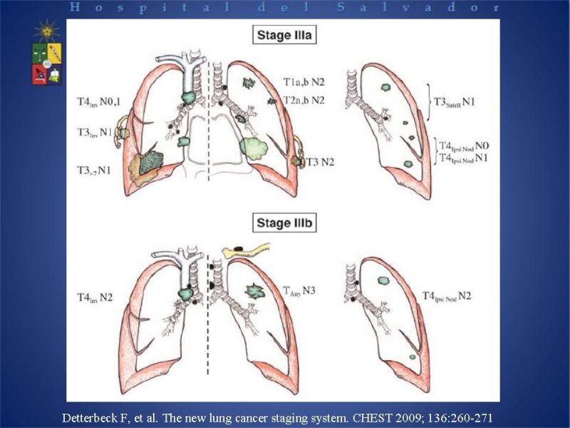 Diapositiva 22 de Cáncer Pulmonar