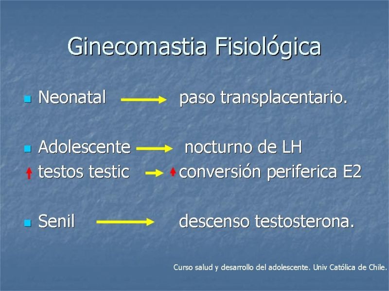 Diapositiva 5 de Ginecomastia