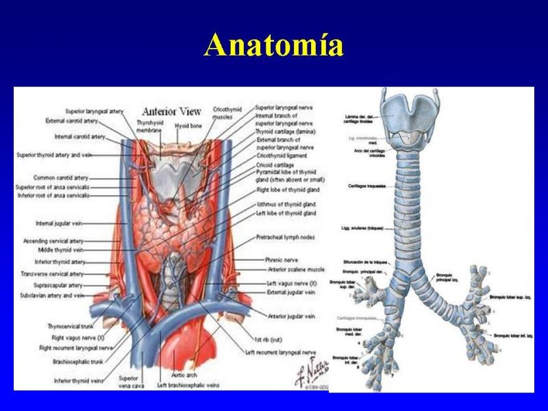 Diapositiva 5 de Traqueostomía