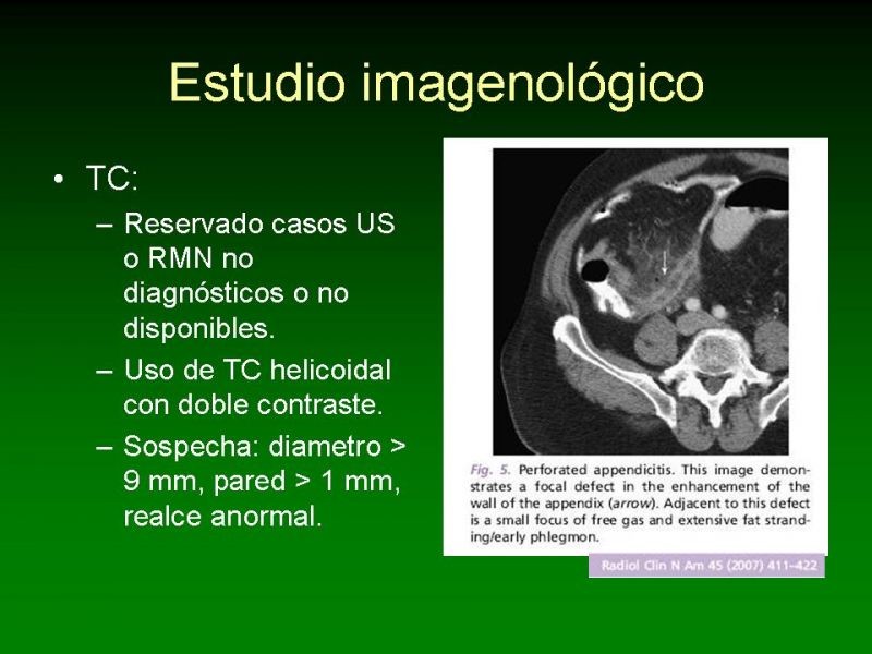 Diapositiva 14 de Apendicitis Aguda y Embarazo