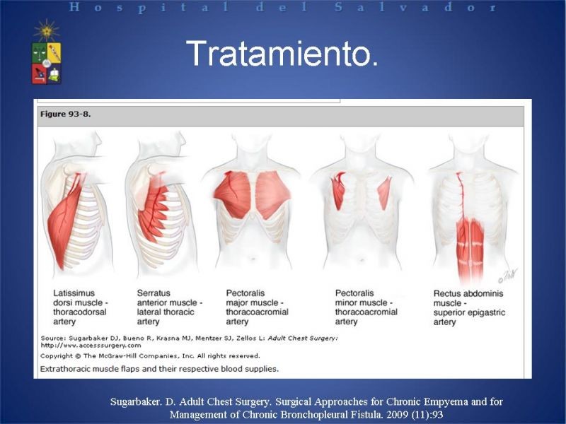 Diapositiva 24 de Empiema Pleural: Paraneumónico, posquirúrgico y post resección pulmonar. Tratamiento quirúrgico.